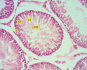 The Effect Of Maternal Exposure To Acesulfame Potassium Acesulfame K On The Development Of The Male Gonad In Adult Rats Springerlink