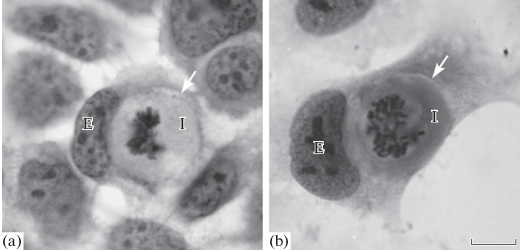 Entosis And Cell Cycle In Tumor Cell Culture Springerlink