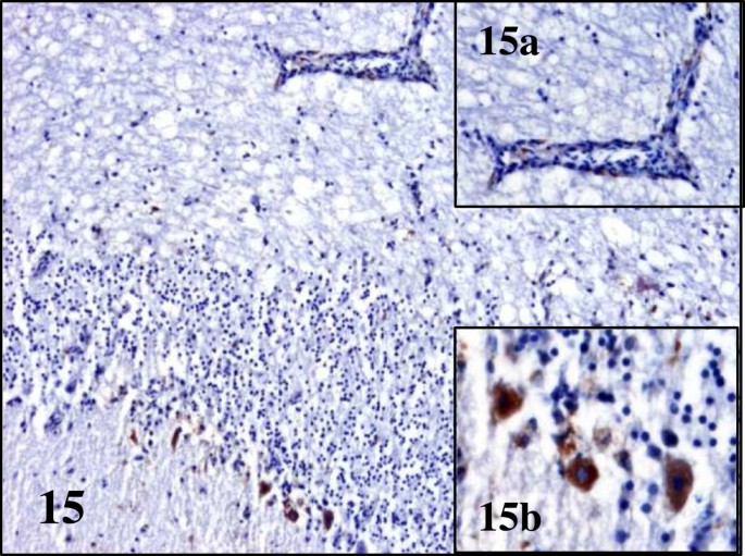 figure 15