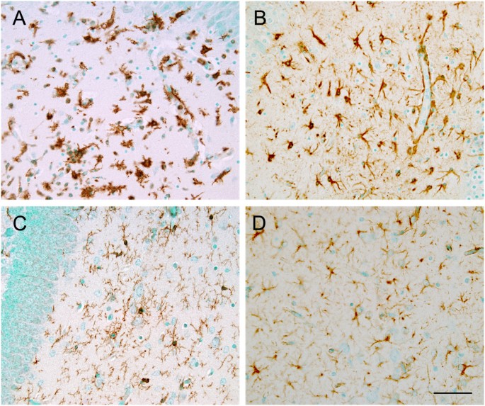 Neonatal influenza infection causes pathological changes in the mouse brain  | Veterinary Research | Full Text