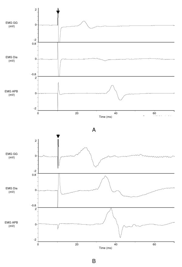 figure 1_788