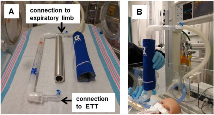 Exhaled breath condensate in intubated neonates- a window into the lung's  glutathione status | Respiratory Research | Full Text