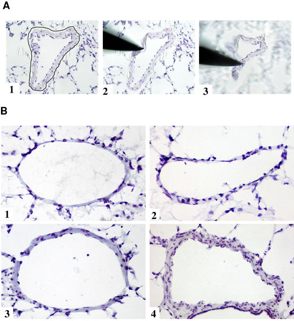 figure 1_347