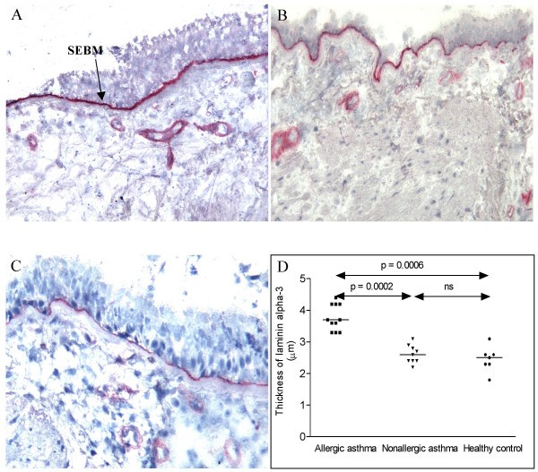 figure 1_348