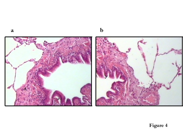 figure 4_293