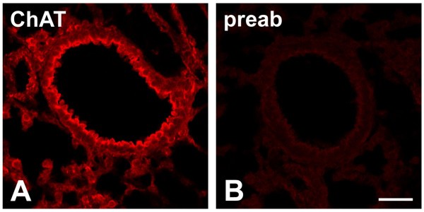 figure 1_456