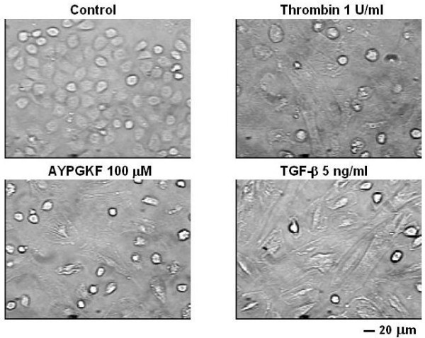 figure 1_569