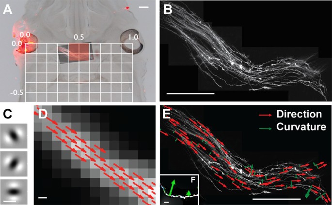 Steerable-filter based quantification of axonal populations at the  developing optic chiasm reveal significant defects in Slit2 −/− as well as  Slit1 −/− Slit2 −/− embryos | BMC Neuroscience | Full Text