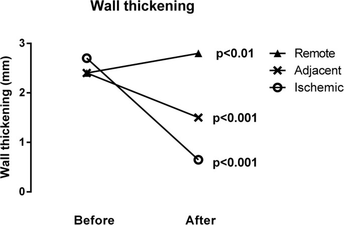 Regional wall function before and after acute myocardial ...