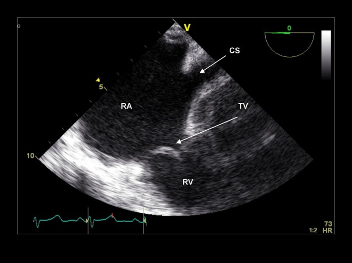 figure 21