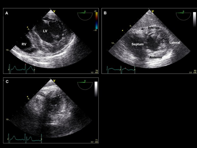 figure 22