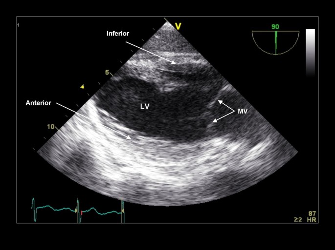 figure 23