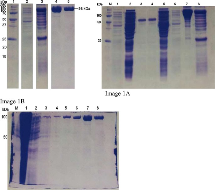 Erratum To: Production of recombinant Entamoeba histolytica pyruvate  phosphate dikinase and its application in a lateral flow dipstick test for  amoebic liver abscess | SpringerLink