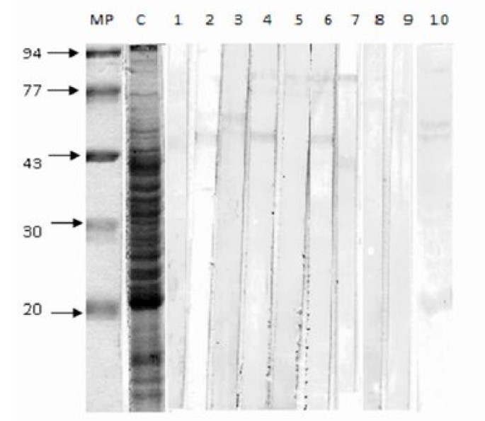 Presence Of Mycoplasma Fermentans In The Bloodstream Of Mexican Patients With Rheumatoid Arthritis And Igm And Igg Antibodies Against Whole Microorganism Bmc Musculoskeletal Disorders Full Text