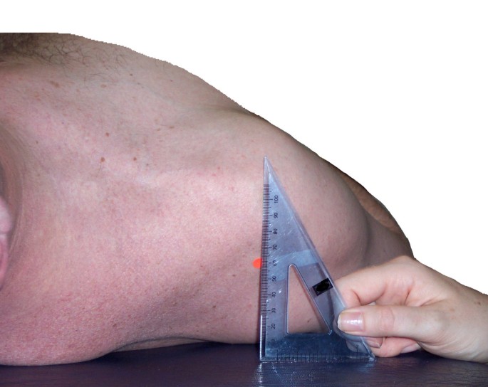 The pectoralis minor length test: a study of the intra-rater ...