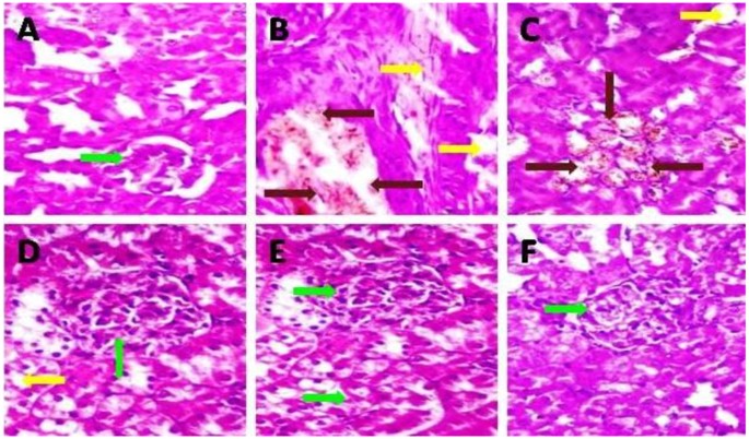 figure 23