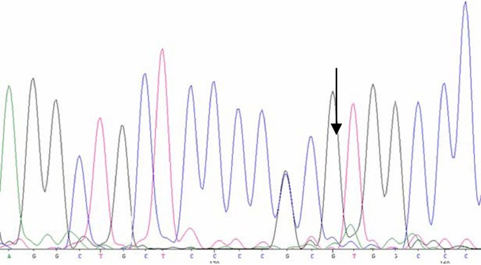 figure 15