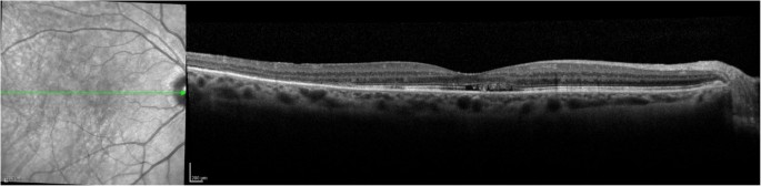 figure 18