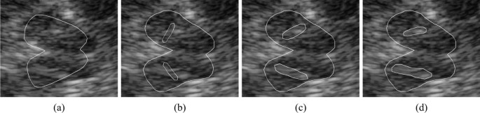 figure 11