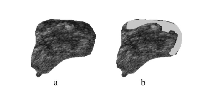 figure 17