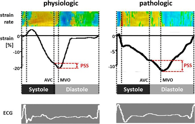 Strain and strain rate