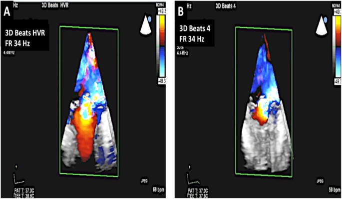 figure 15