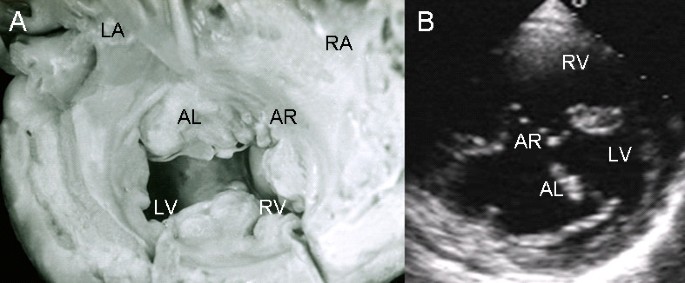 figure 18