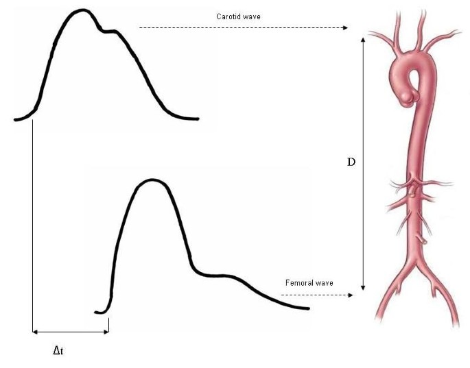 carotid pulse wave