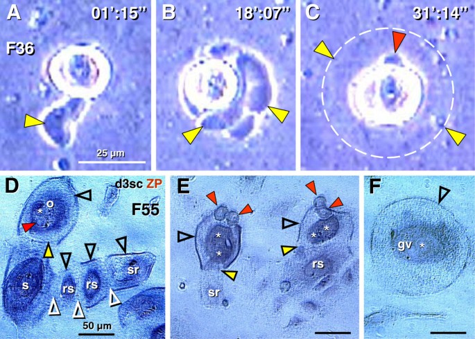 figure 15