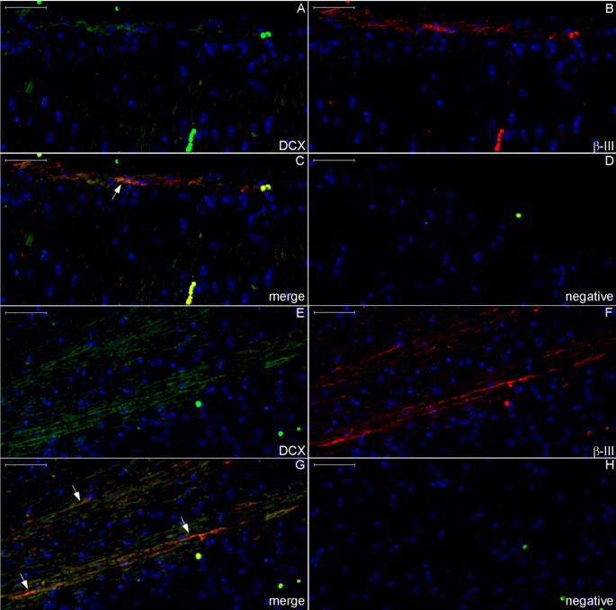 figure 22