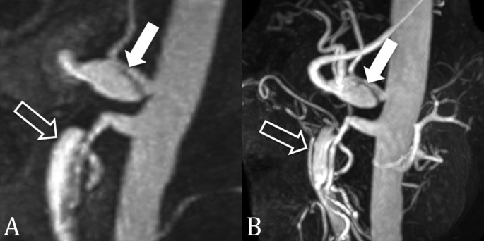 Magnetic resonance angiography: current status and future directions |  Journal of Cardiovascular Magnetic Resonance | Full Text