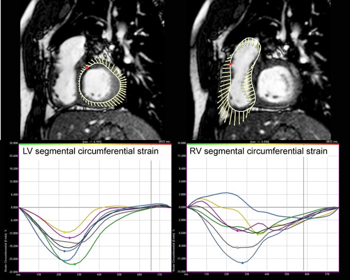 figure 22