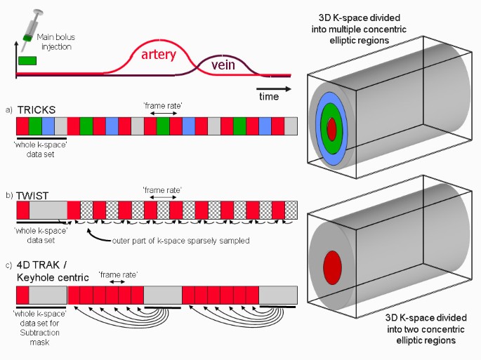 figure 30