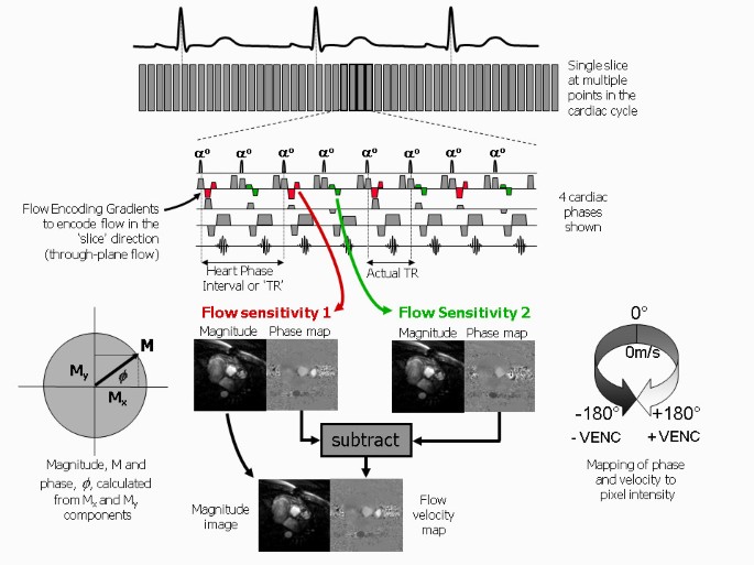 figure 35