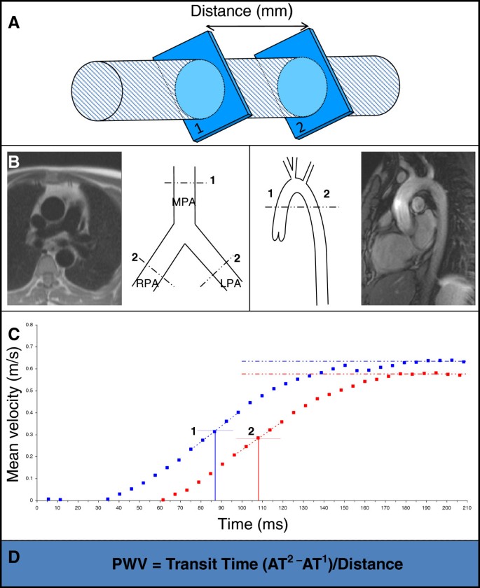 figure 28