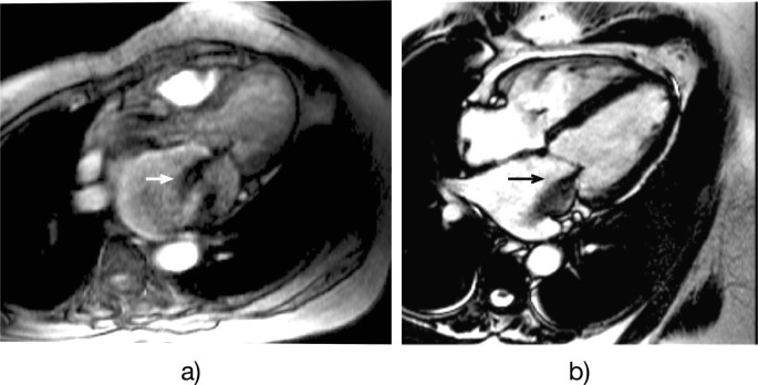 figure 27