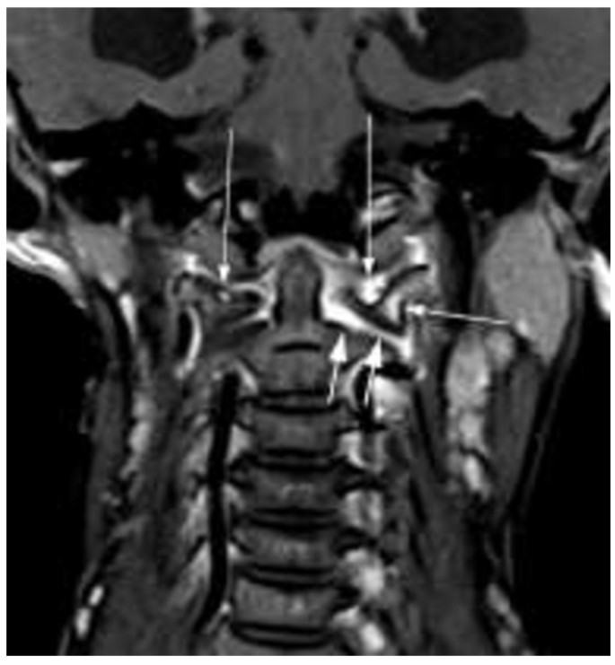 Specialty Imaging: Temporomandibular Joint, Radiologie - adamos.ro