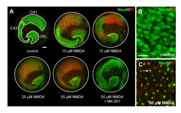 figure 1_515