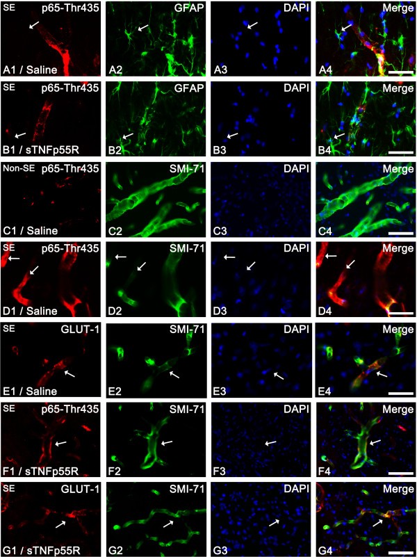 figure 5_535