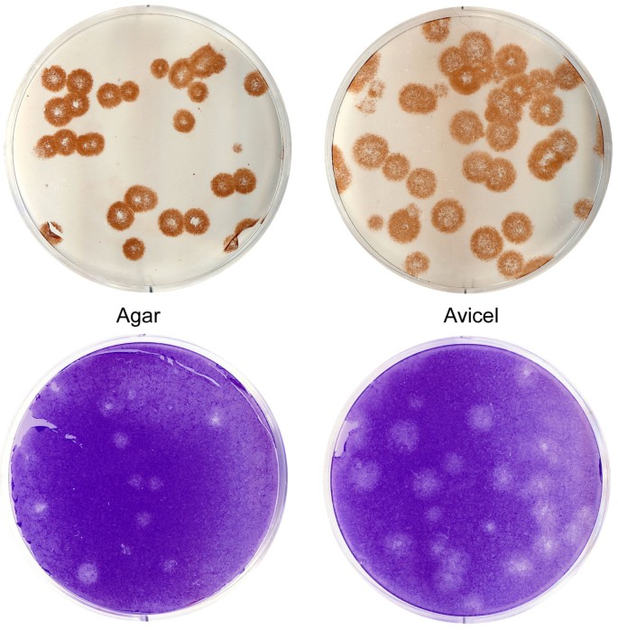 New low-viscosity overlay medium for viral plaque assays | Virology Journal  | Full Text