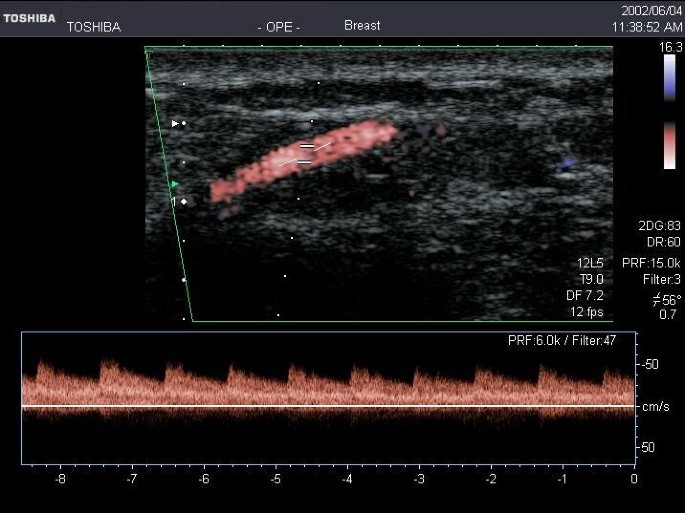 figure 11