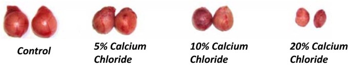 Saline Injections Scrotum Saline Injections Scrotum