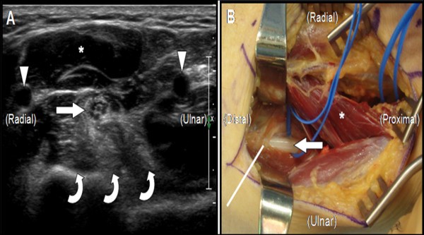 figure 1_32