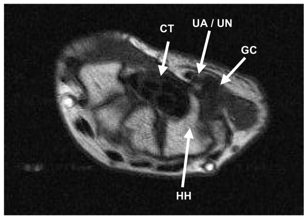 figure 1_37