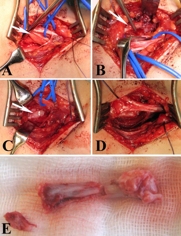 figure 3_74