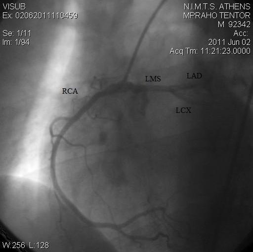 An unusual pattern of three major components of the cardiovascular system:  multimodality imaging and review of the literature | Journal of  Cardiothoracic Surgery | Full Text