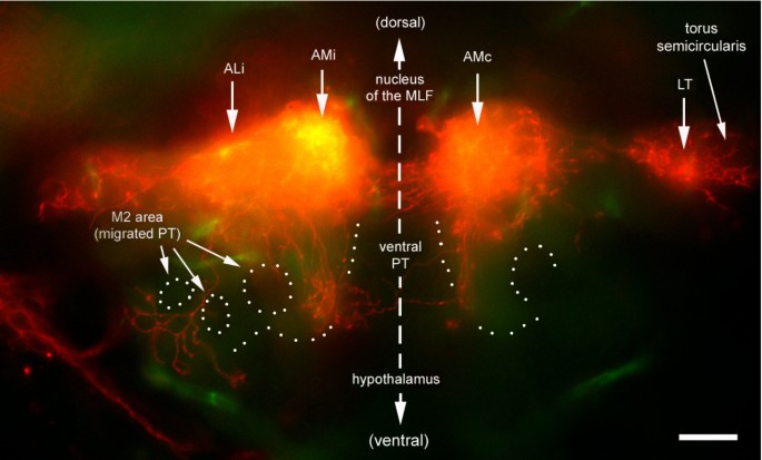 figure 14