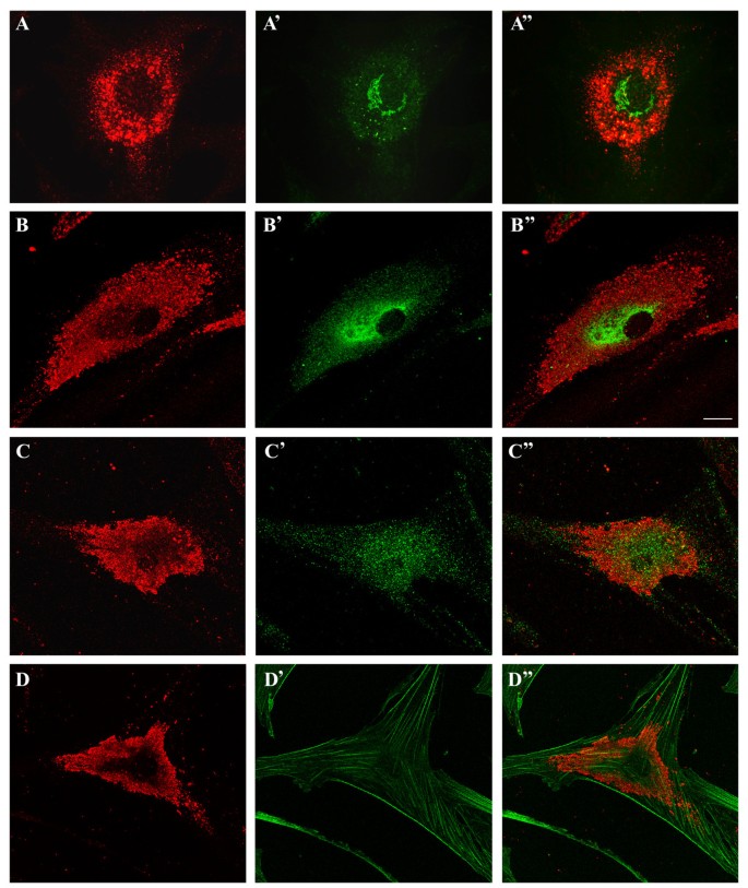 Laboratory diagnosis of Niemann-Pick disease type C: the filipin staining  test.