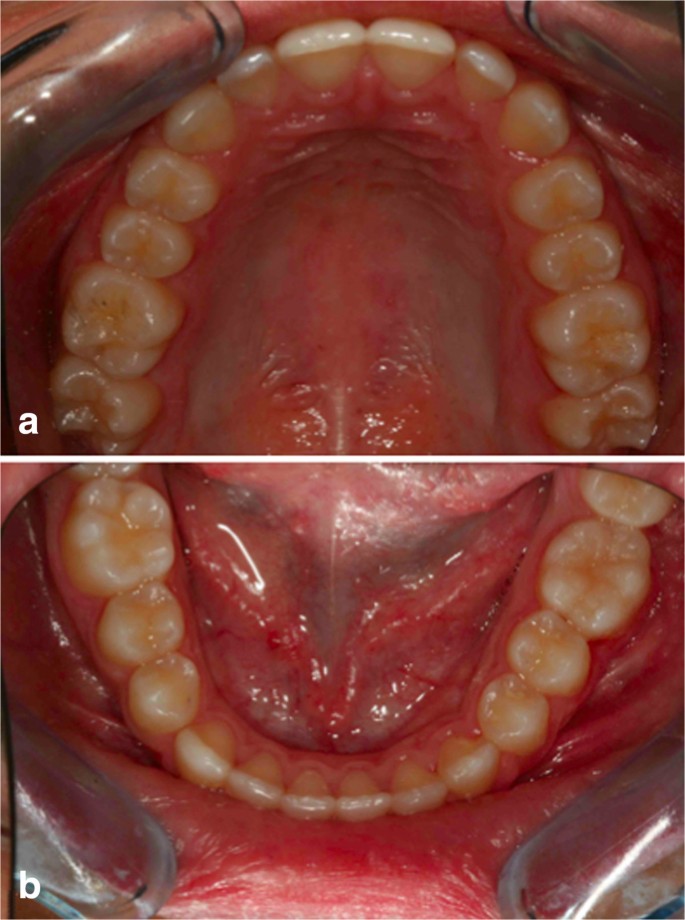 figure 27