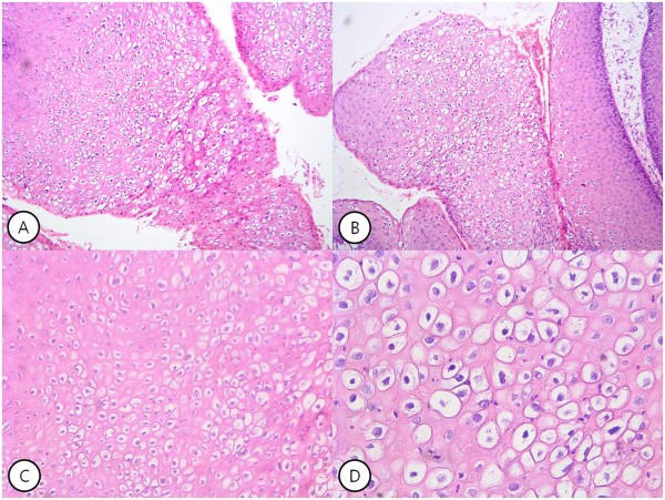 Papilloma a kutya szájában. Mastocitoma (hízósejtes daganat) a kutyáknál - K9 Immunity